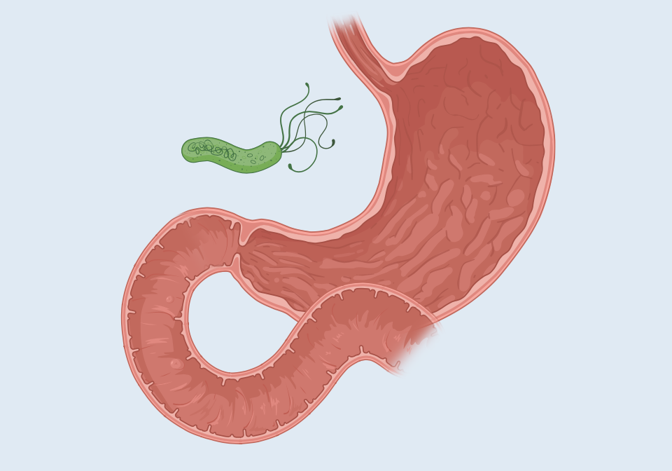 Pylori